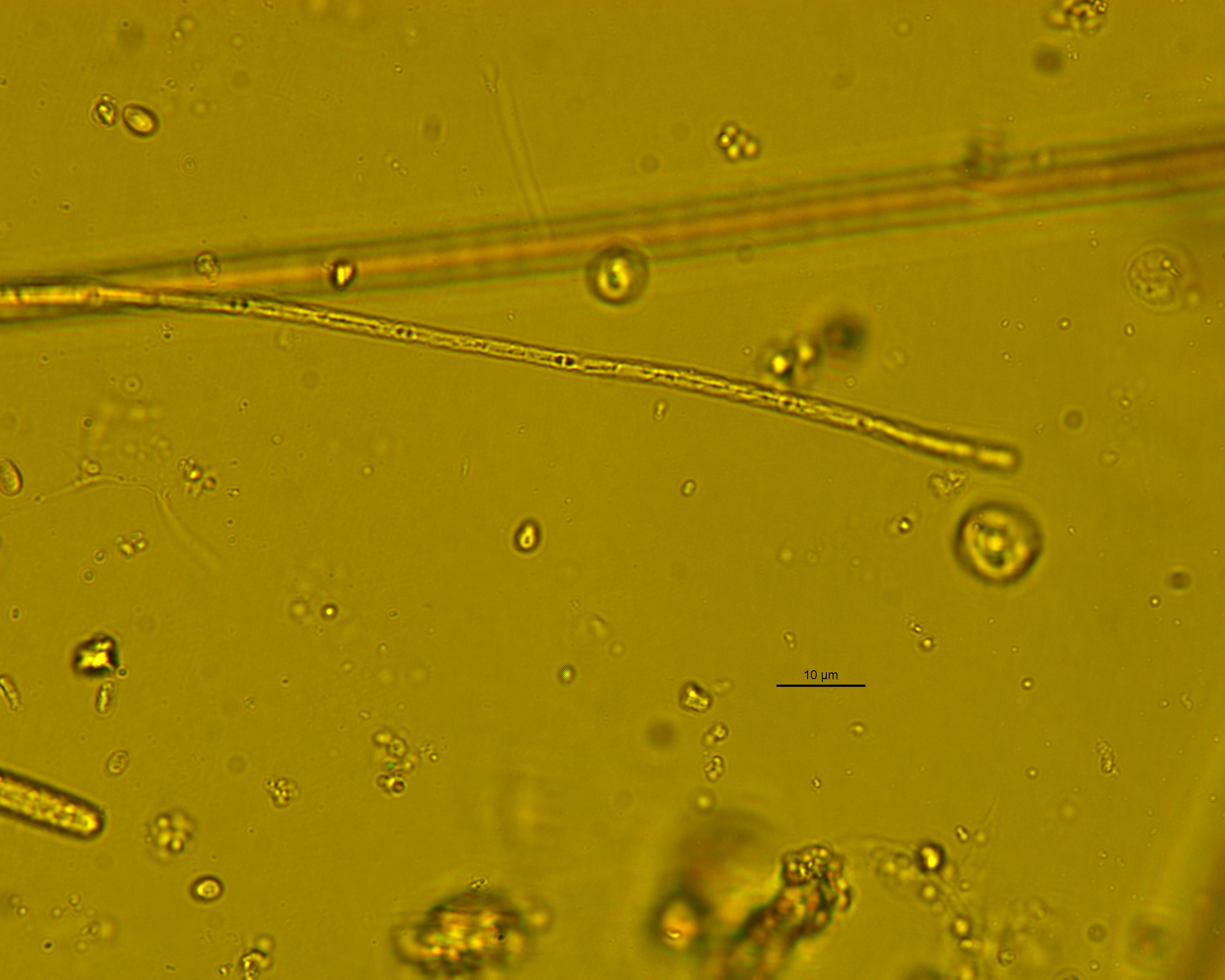 Dictyocha speculum